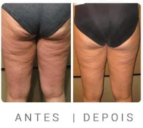 Kit Topo Benefícios